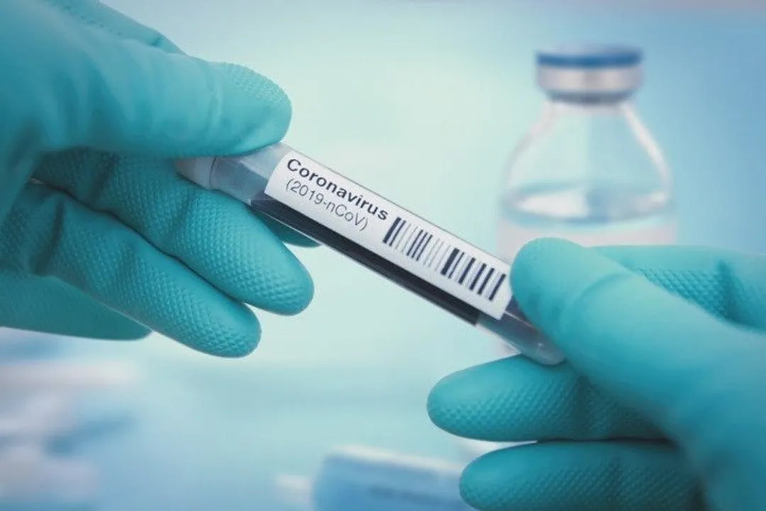Coronavirus / Covid
