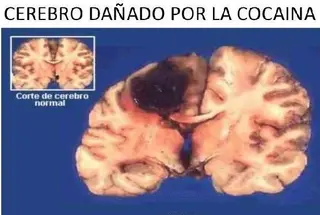 Detrás del 'yo controlo', daños neurológicos irreversibles