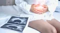 Cáncer de ovario. Infosalus