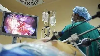 Cribado del cáncer colorrectal