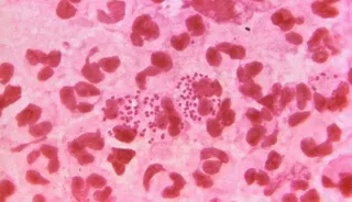 Sífilis vista con un microscopio EP