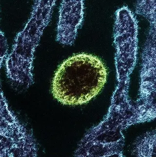 Imagen de archivo del virus Nipah-NIAID