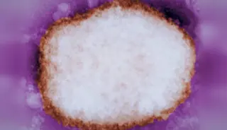 Partícula amplificada del virus de la viruela del mono. EP