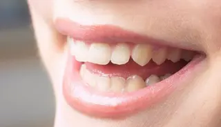 Dientes