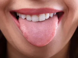Lengua
