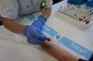 Pruebas alergia hospital
