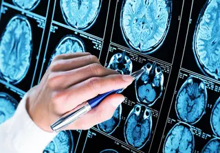Imagen de recurso sobre distintas zonas de un cerebro. US Archivo