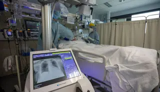Desciende la ocupación Covid en Planta, pero aumentan los pacientes en UCI por otras patologías