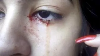 Llora sangre